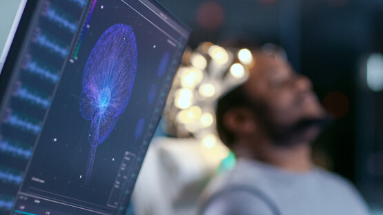 Monitor with 3D visualisation of brain activity, person wearing EEG cap in the background during neurological examination