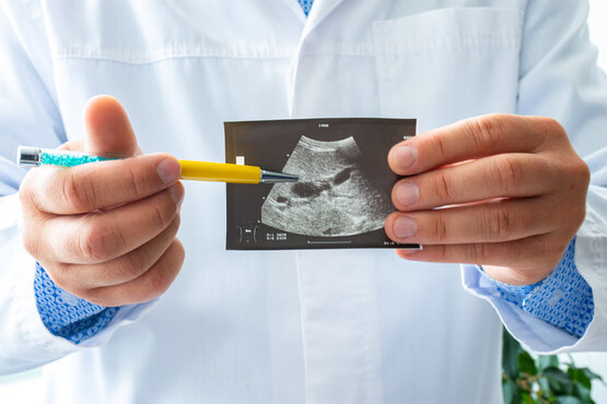 Doctor holds ultrasound image of gallbladder with visible gallstones and points to the findings with a ballpoint pen.