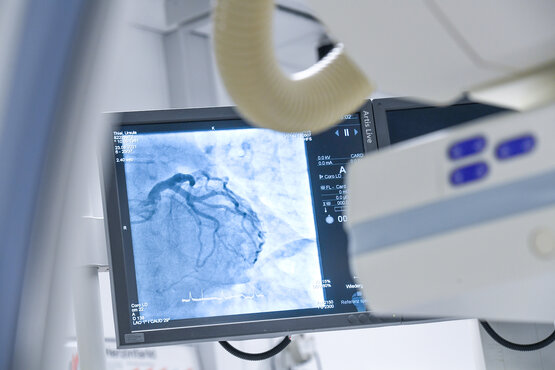 Monitor displays angiogram of coronary angiography in cardiac catheterisation laboratory, medical examination device in foreground