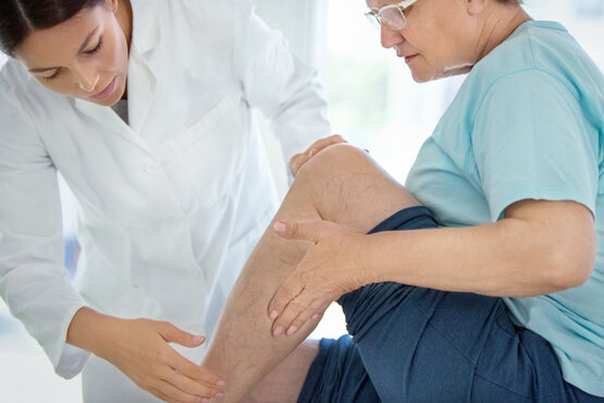A doctor in a white coat examines the left leg of a seated person wearing glasses, with blue veins clearly visible on the leg